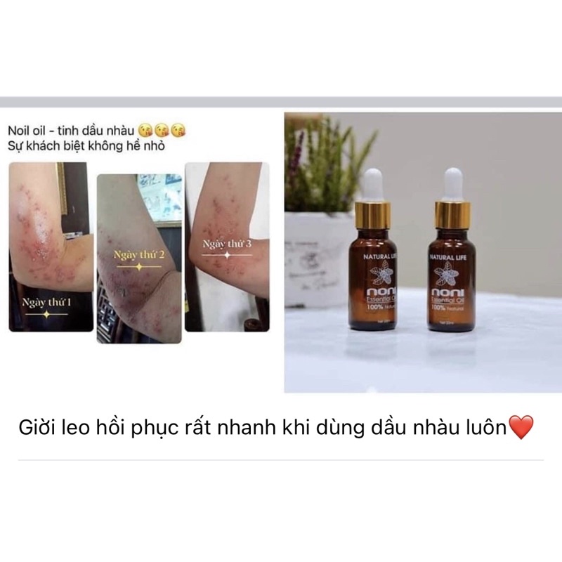 TINH DẦU TRÁI NHÀU - NONI OIL