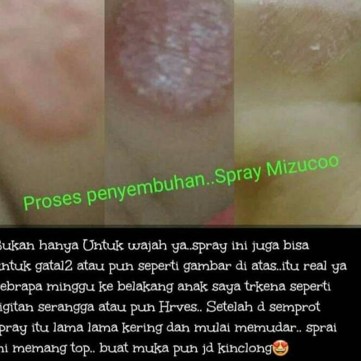 ⭐ Xịt Cố Định Mizuco (Bộ 139) (trims,.) | BigBuy360 - bigbuy360.vn