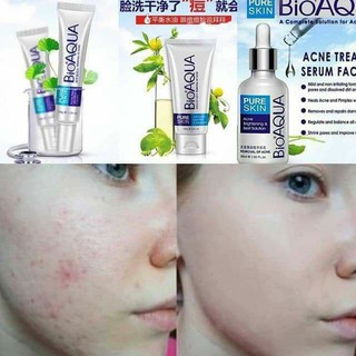 Combo kem và serum đặc trị mụn BIOAQUA
