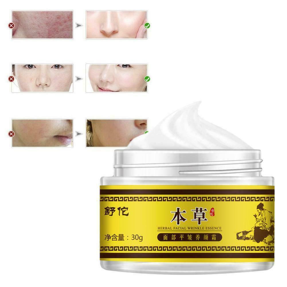 [Hàng mới về] Kem chống nếp nhăn dưỡng ẩm chăm sóc da mặt O6N4