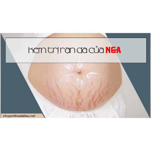 Kem tan mỡ bụng và rạn da cao cấp, cam kết eo thon, bụng hết dạn chỉ trong 3 tháng [chính hãng Nga 100%]