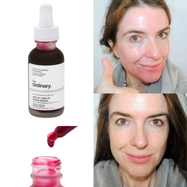 Serum Peel Da The Ordinary AHA 30% + BHA 2% Peeling Solution 30ml