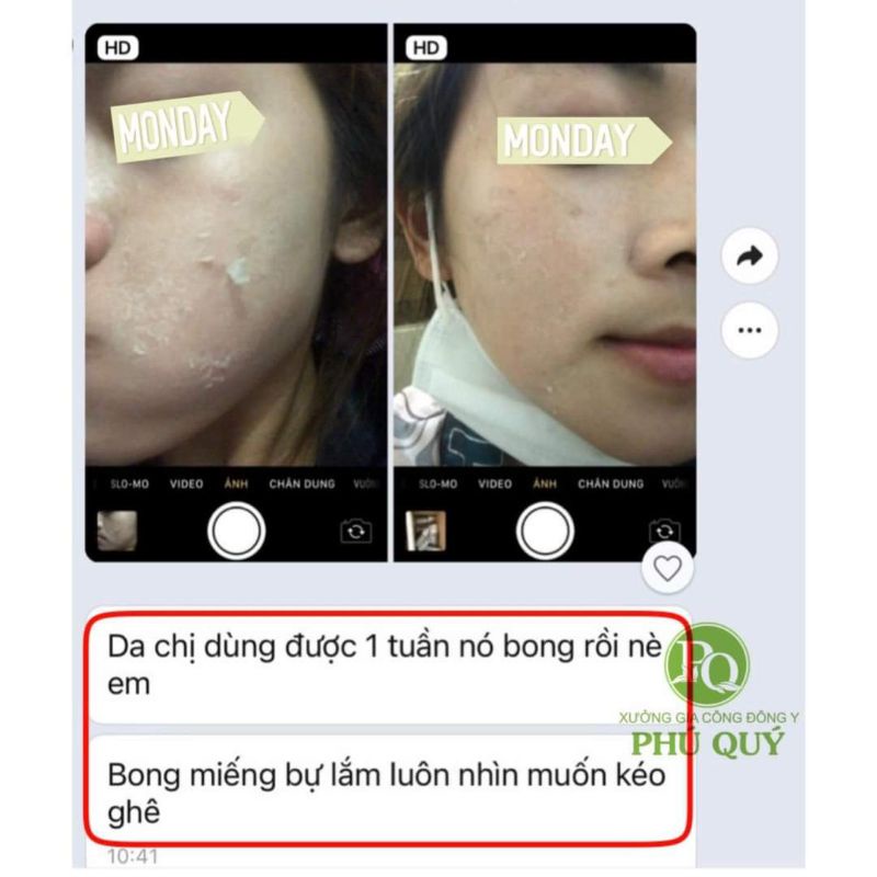 Kem tái tạo da sâm đen