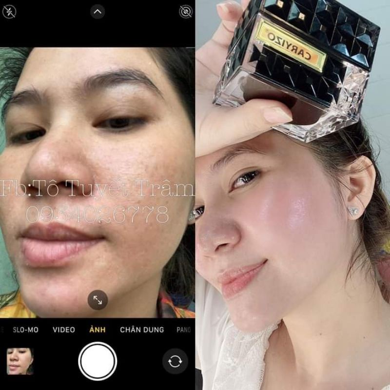 Kem Face nám tàn nhang da không đều màu