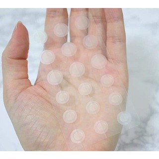 Miếng dán mụn AHA Some by mi