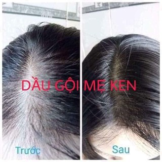 DẦU GỘI THẢO DƯỢC MẸ KEN