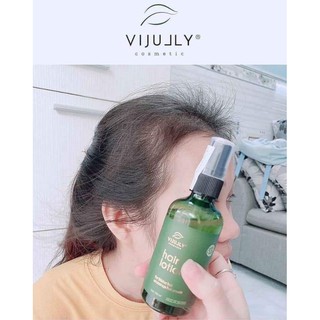 Tinh dầu Vi-Jully kích thích mọc tóc