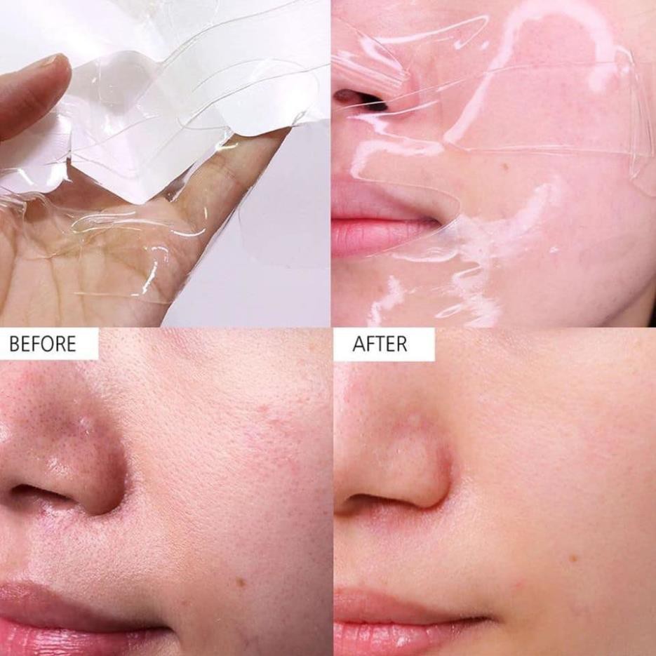 Hộp 4 miếng mặt nạ thạch Celderma hồng Ninetalks Hydrogel Mask