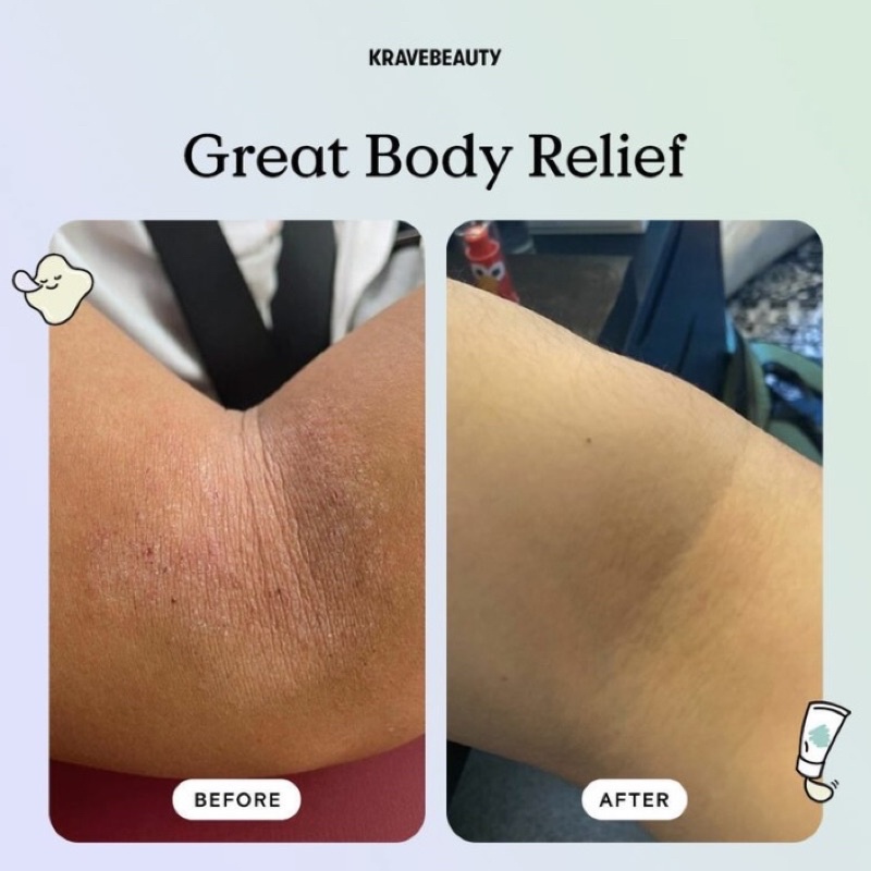 KEM DƯỠNG THỂ PHỤC HỒI DA KRAVE BEAUTY GREAT BODY RELIEF