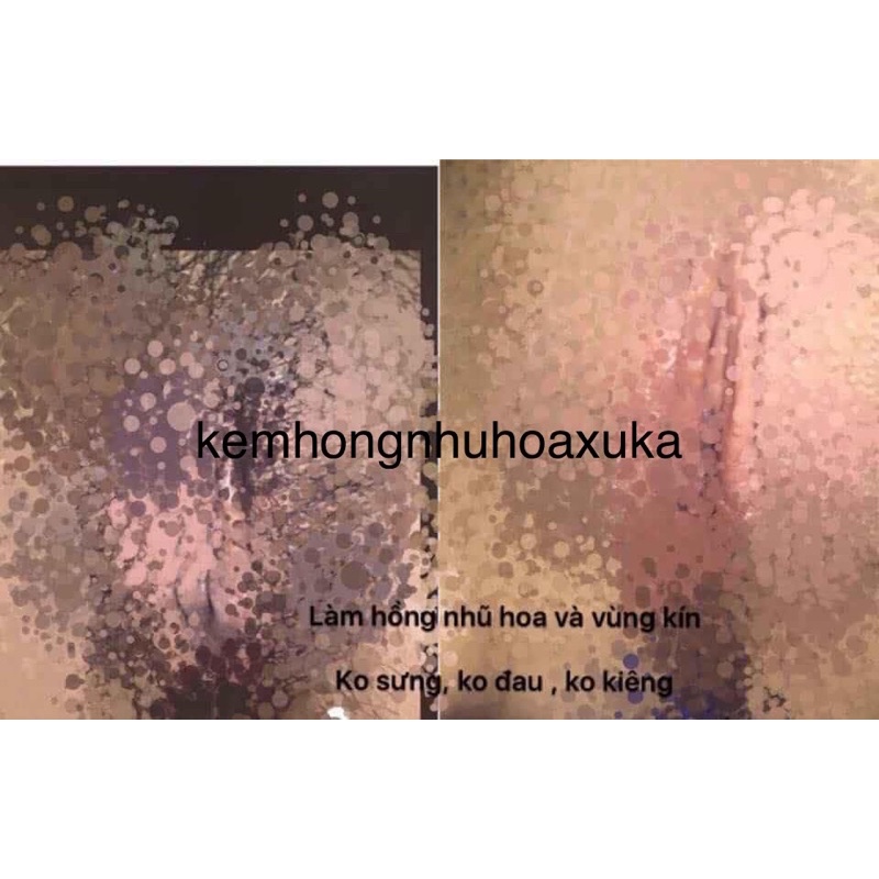 Kem hồng nhũ hoa Xuka công nghệ 2021 (bảo đảm hồng, hàng độc quyền shop, ko bỏ sỉ) | BigBuy360 - bigbuy360.vn