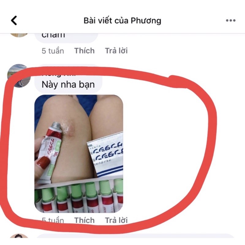 Thuốc gentamicin 10g trị sẹo của Nhật dạng kem [ Hàng chính hãng ] | BigBuy360 - bigbuy360.vn