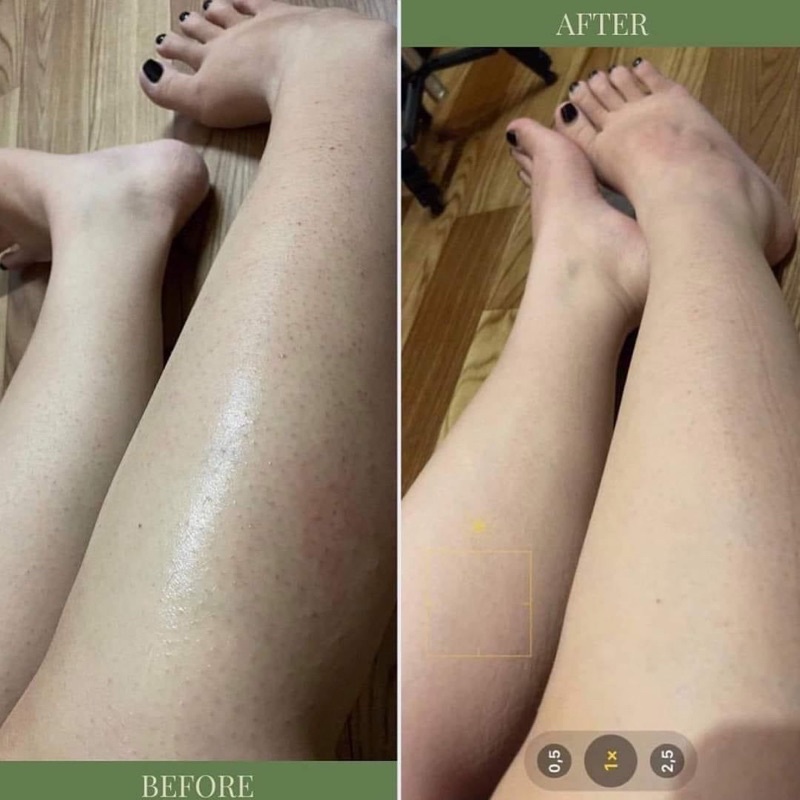 BODY OIL 4% BHA NÂNG CẤP