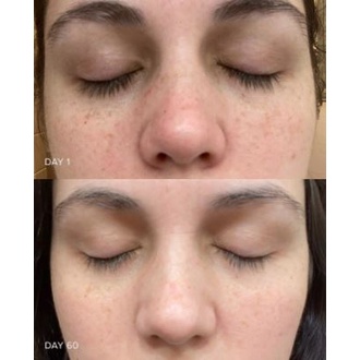 Kem Dưỡng Ban Đêm Ngăn Lão Hóa, Giảm Nếp Nhăn Eucerin Anti-age Hyaluron-filler+ Elasticity Night Cream 50ml