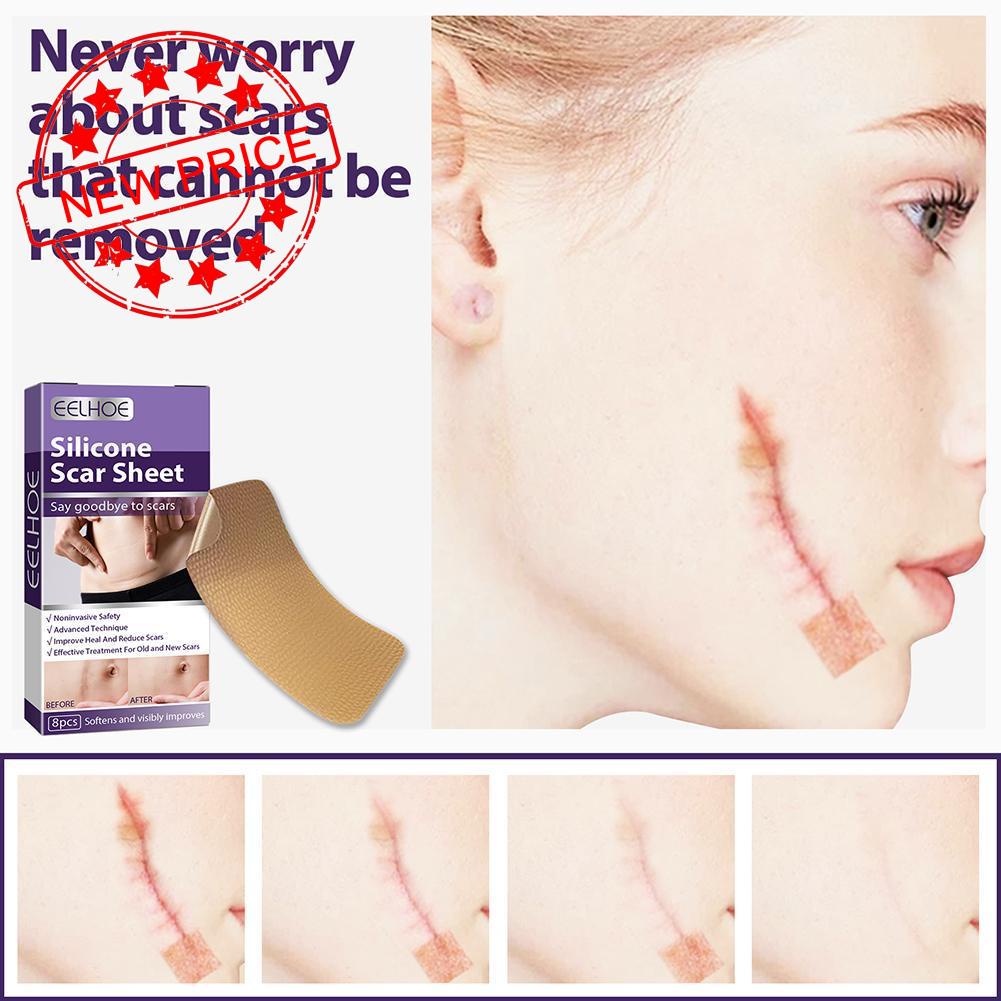 Bộ 8 Miếng Dán Silicone Hỗ trợ giảm sẹo Làm Sáng Tông Màu Da Q2T4