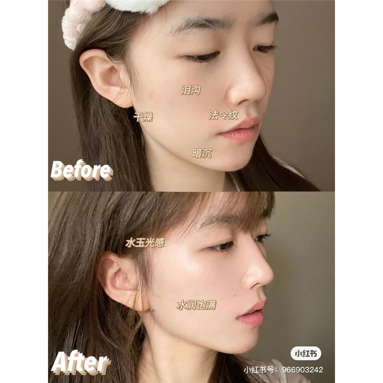 Tinh Chất Shiseido Elixir Chống Lão Hóa Da 40ml