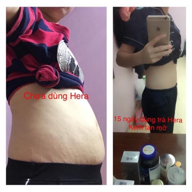 Kem tan mỡ bụng Hera ❤️FREESHIP❤️Gel tan mỡ Hera Plus, đánh tan mỡ bụng, giảm cân hiệu quả, an toàn