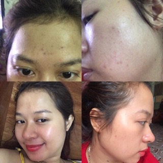 Bột xông thiên nhiên thải độc da