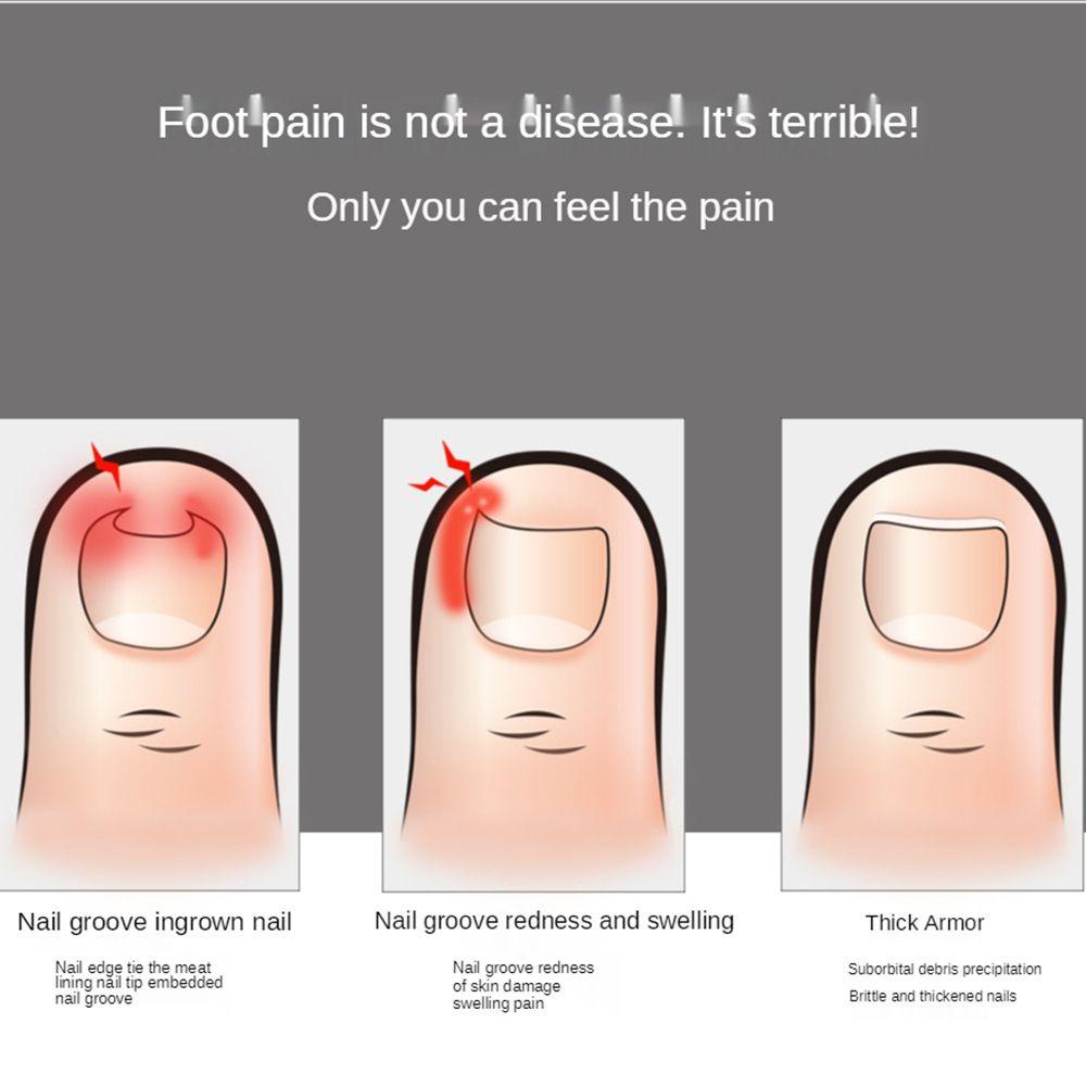 Kìm Cắt Móng Tay Chuyên Dụng Chất Lượng Cao