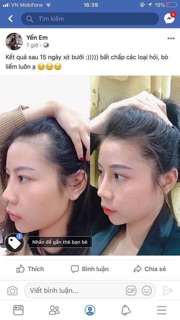 Tinh dầu bưởi trị rụng