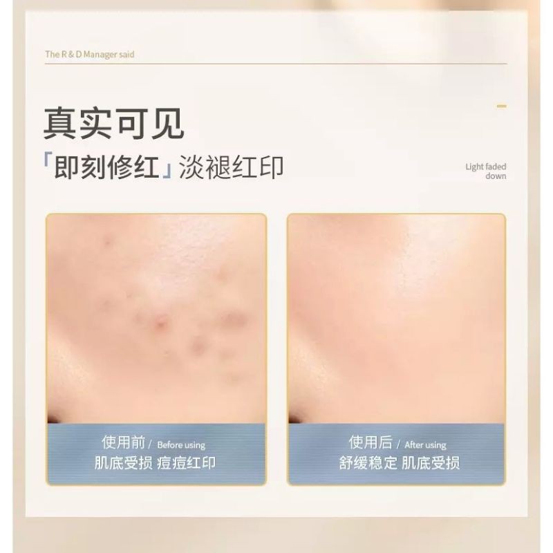 Serum B56 Lucenbase [bản 15ml]