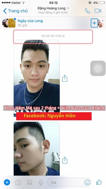 Tinh chất thon hàm má, thu xương quai hàm, hạ gò má cao | BigBuy360 - bigbuy360.vn