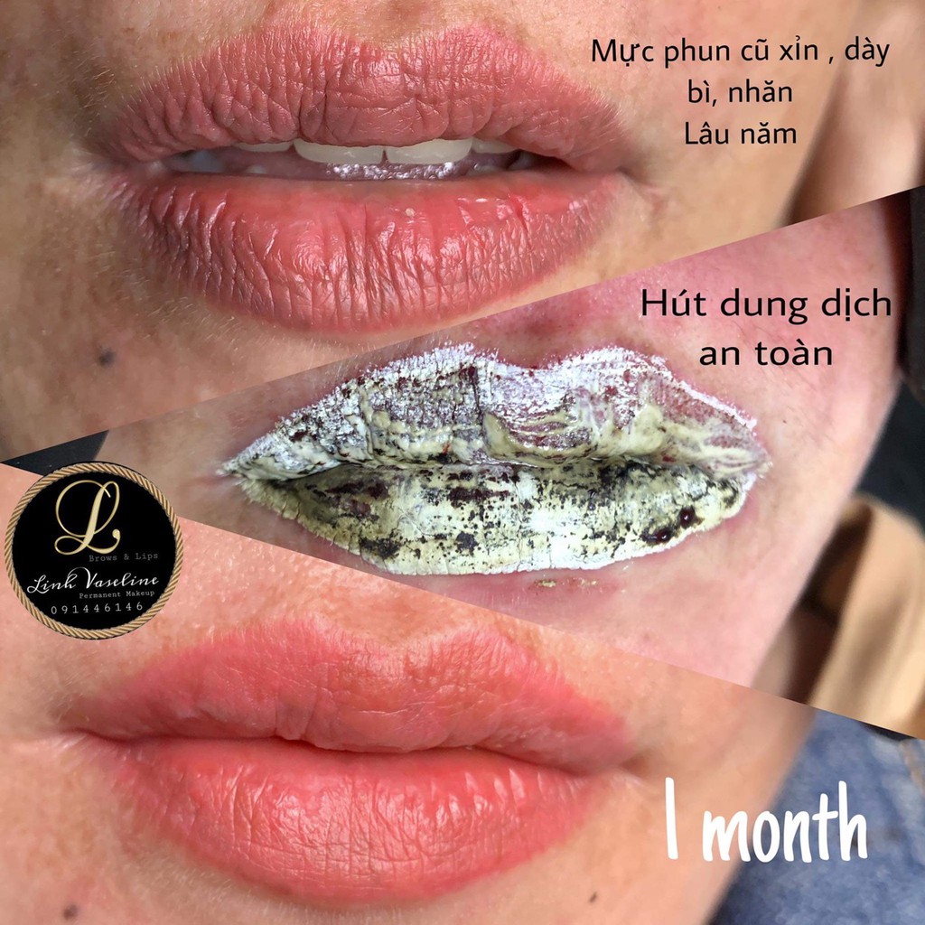Dung dịch xóa Rejuvi