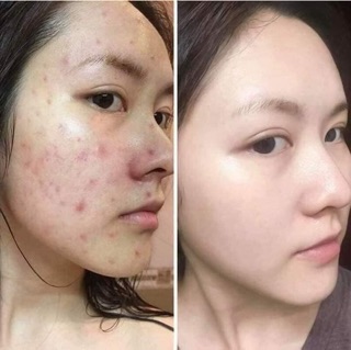 Combo kem Collagen plus vit E