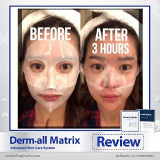 Siêu phẩm Mặt nạ Derm All Matrix Mask Hàn Quốc