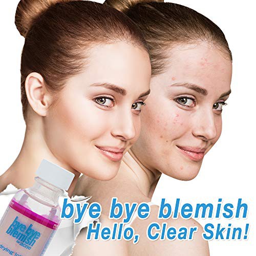 Lotion Chấm Xẹp Mụn Sưng Siêu Đỉnh Bye Bye Blemish Drying Lotion 30ml