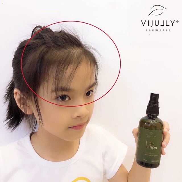 Combo 2 chai Tinh Dầu Bưởi Vi Jully Hair Lotion, Ngăn Rụng Tóc, Dưỡng Ẩm ok