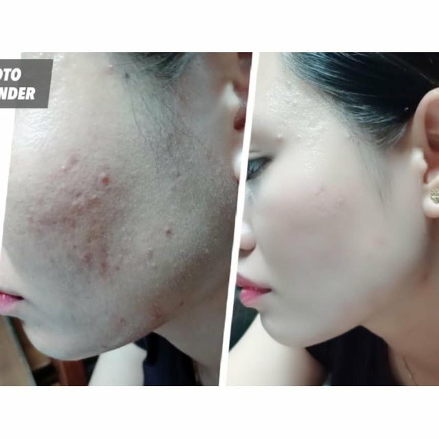 Phấn nước Hàn Quốc Cushion R&B 2 lõi | BigBuy360 - bigbuy360.vn