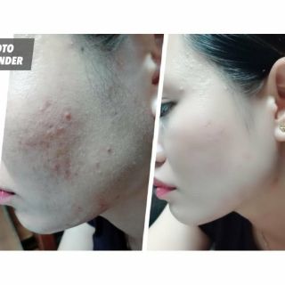 Phấn nước Hàn Quốc Cushion R&B 2 lõi