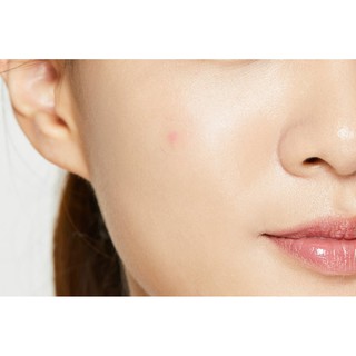 Dán Mụn COSRX Acne Pimple Master Patch 24 miếng EffeSkin