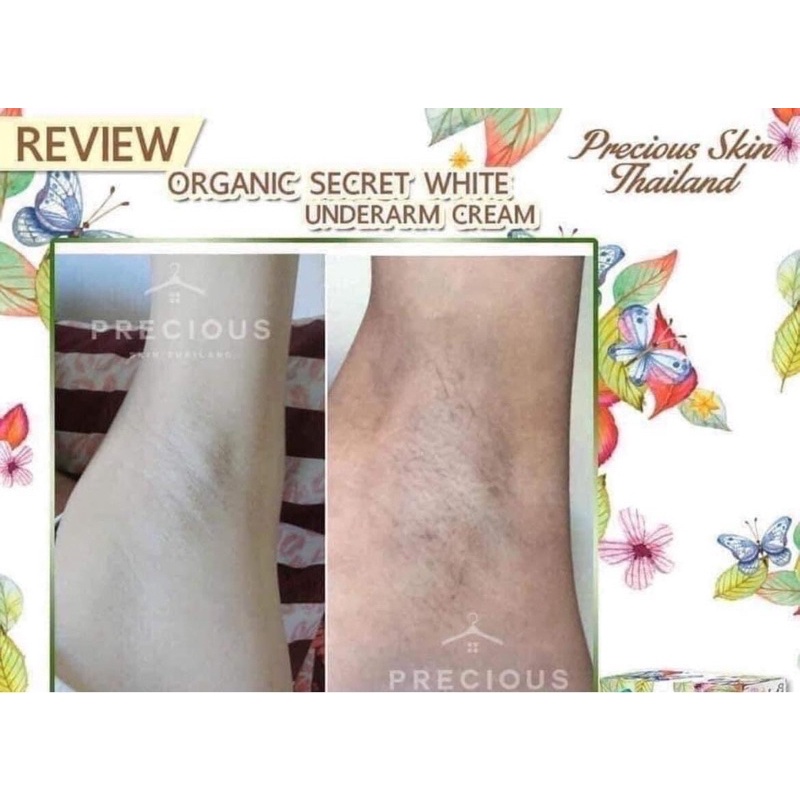 Kem Giảm Thâm Nách, Khử Hôi Nách  Giảm Thâm Đầu Gối, mông Skin Organic Secret White Thái Lan 50g