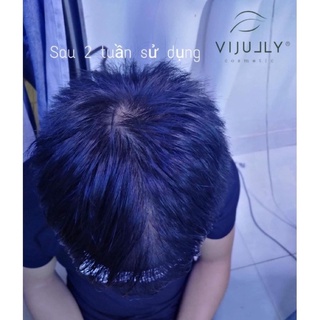 Dầu gội vijully-chính hãng