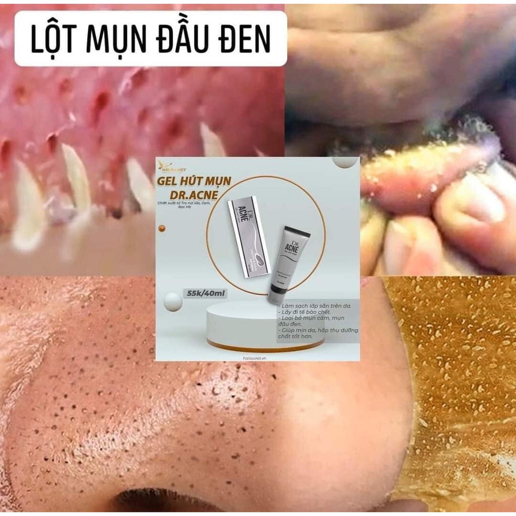 GEL HÚT MỤN THAN TRE DR.ACNE