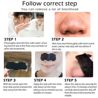OEDO 20PCS Rose Blackhead Nose Patch