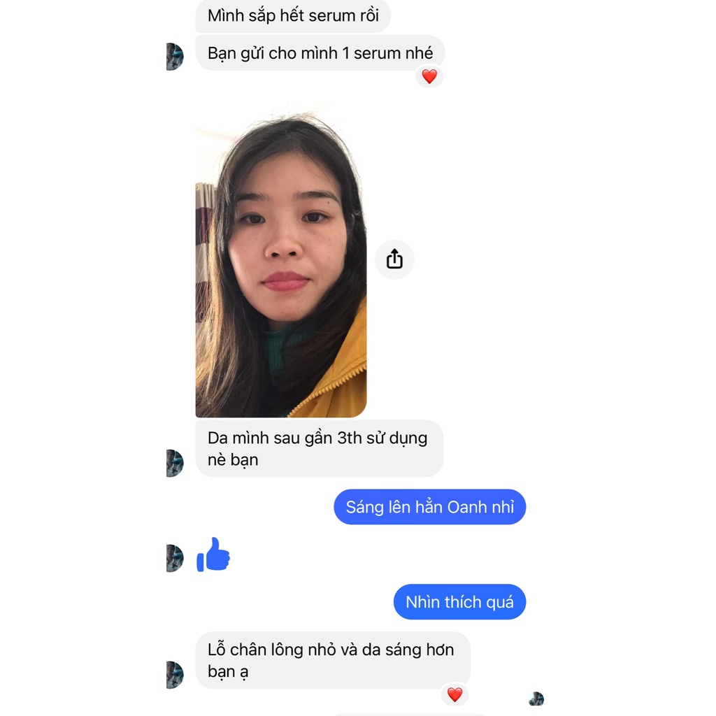 Serum dưỡng da, serum chống lão hóa Doskin