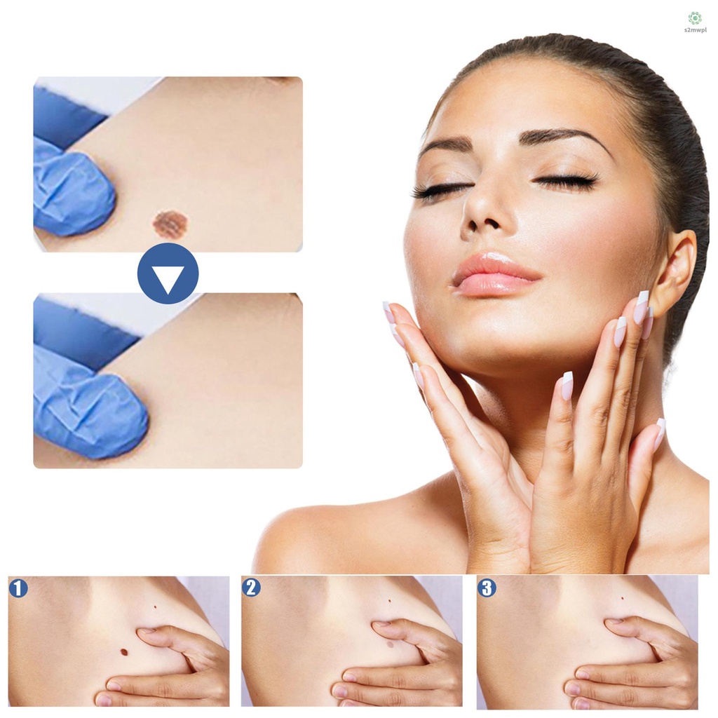 Bộ 144 Miếng Dán Loại Bỏ Mụn Cóc Thành Phần Tự Nhiên EELHOE s2mw