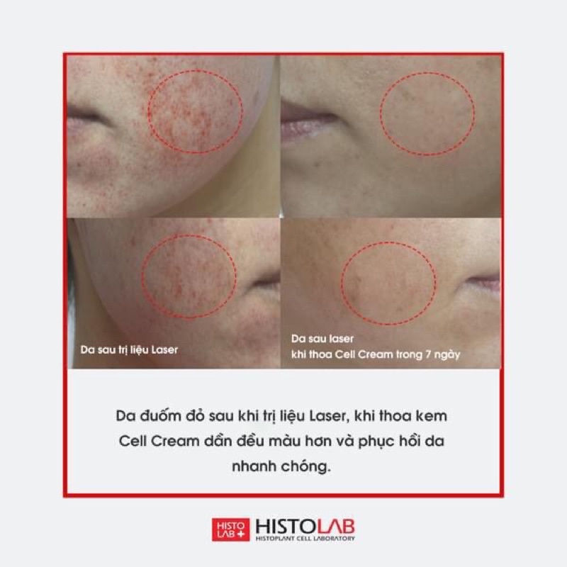 [Histolab] kem tái tạo da cell cream 12ml