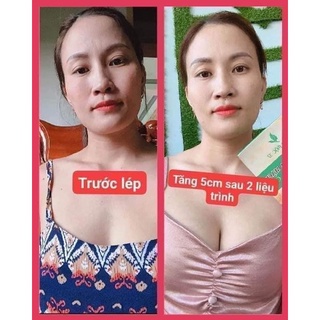Kẹo mầm lúa mạch Gold- thảo mộc 37 ( chính hãng)