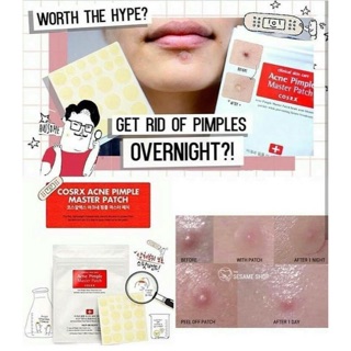 DÁN MỤN COSRX ACNES PIMPLE MASTER PATCH