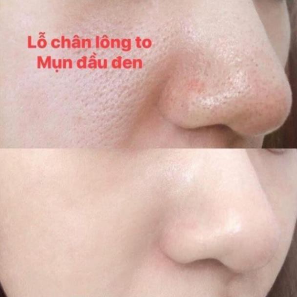 Kem Se Khít Lỗ Chân Lông SQS Nhật Bản 15g