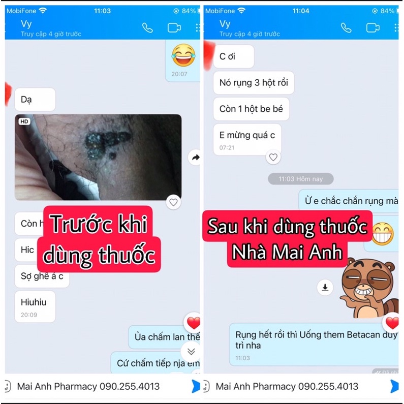 Combo Betacan Bôi+Uống loại bỏ mụn hpv