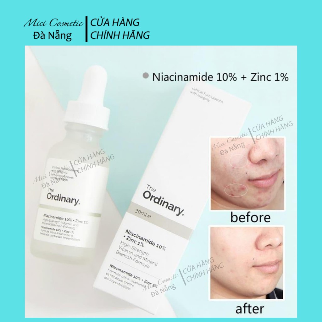 SERUM NGĂN NGỪA MỤN, SÁNG DA NIACINAMIDE 10% + ZINC 1% | BigBuy360 - bigbuy360.vn
