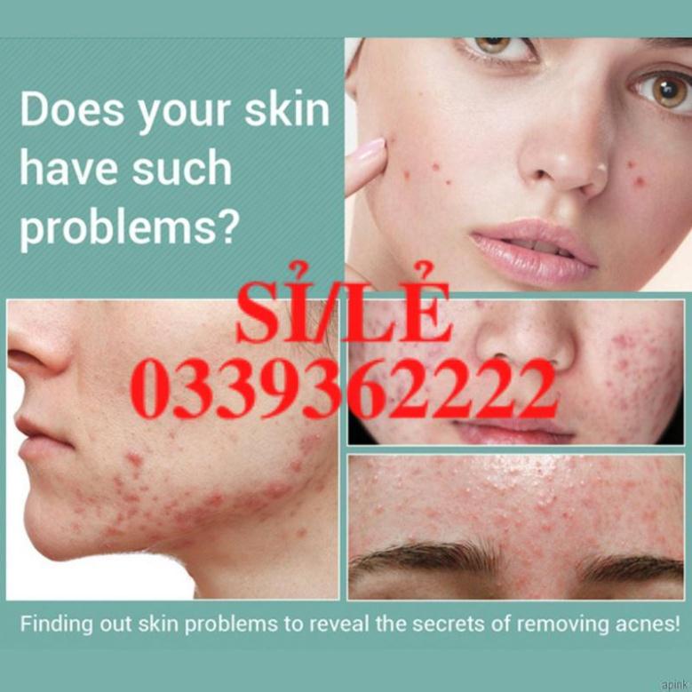 [Hàng mới về] Gel dưỡng da giảm mụn làm mờ sẹo Lanbena 20g  HAIANHSHOP