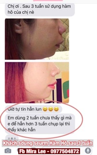 Tinh Chất Hàm Hô Miracle