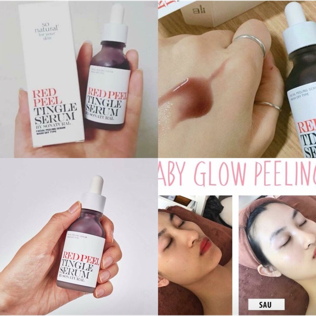 [CÓ SẴN - AUTH] Red Pell 35ml thay da sinh học không bong tróc