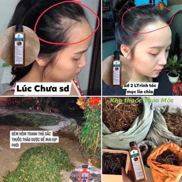 [10 chai 190k ] Tinh dầu gội thảo mộc | BigBuy360 - bigbuy360.vn