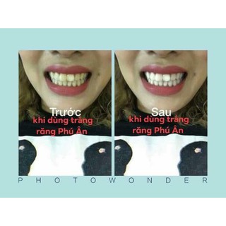Bột trắng răng Mints